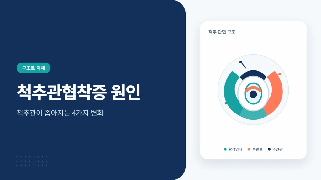 척추관협착증 원인 썸네일