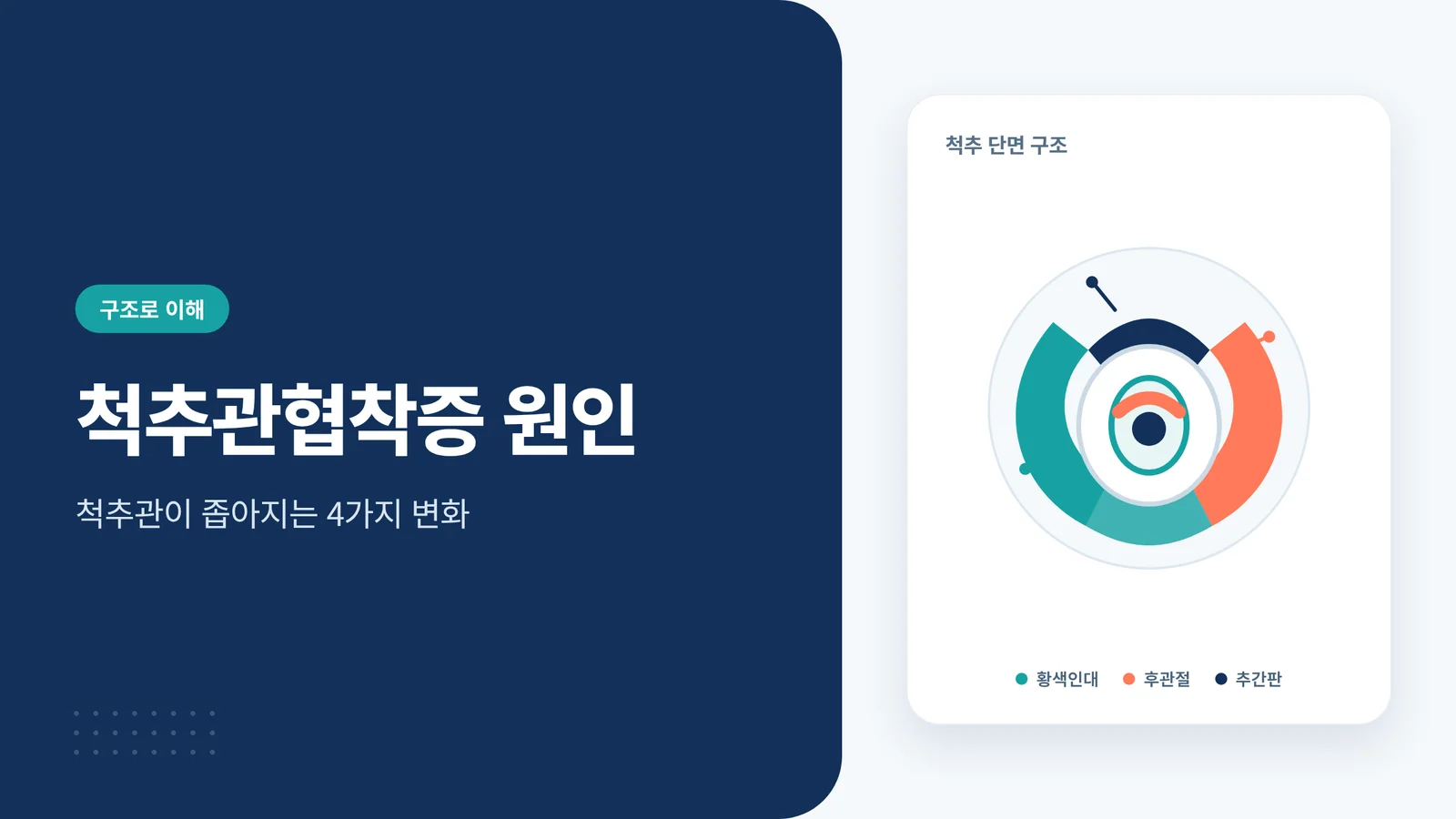 척추관협착증 원인